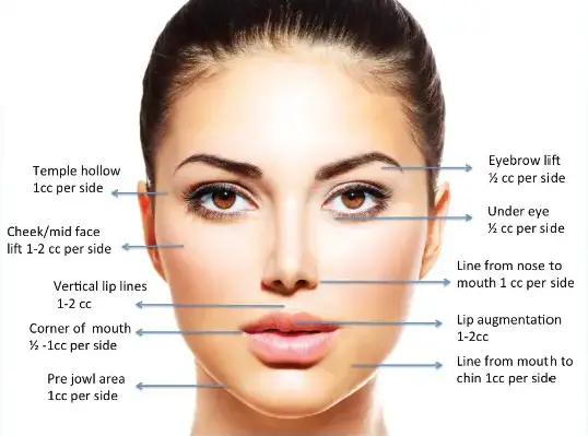 Bridal Packages 4 Bridal Dermal filler