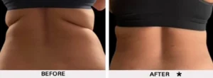Safesculpt BA b