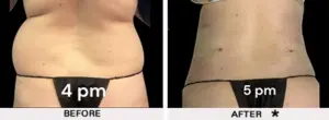 SafeSculpt B A a