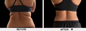 SafeSculpt B A o