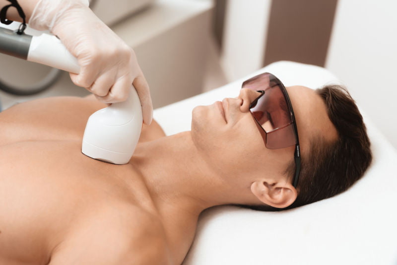 Laser hair Reduction For Men | Rejuvenation Center