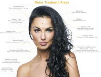 Botox Treatment Areas | Rejuvenation Center | Wheeling, WV