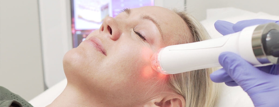 Vivace RF | Rejuvenation Center | Wheeling, WV