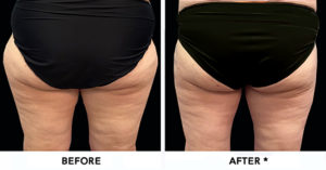 safesculpt
