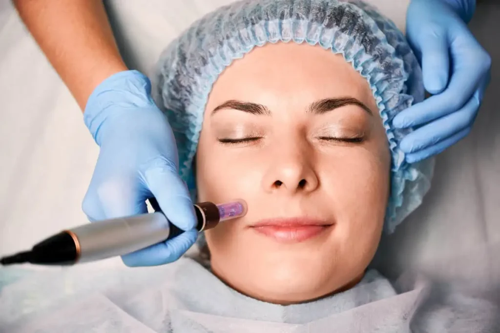 Microneedling by The Rejuvenation Center II, LLC in . Bethlehem Blvd. Wheeling WV