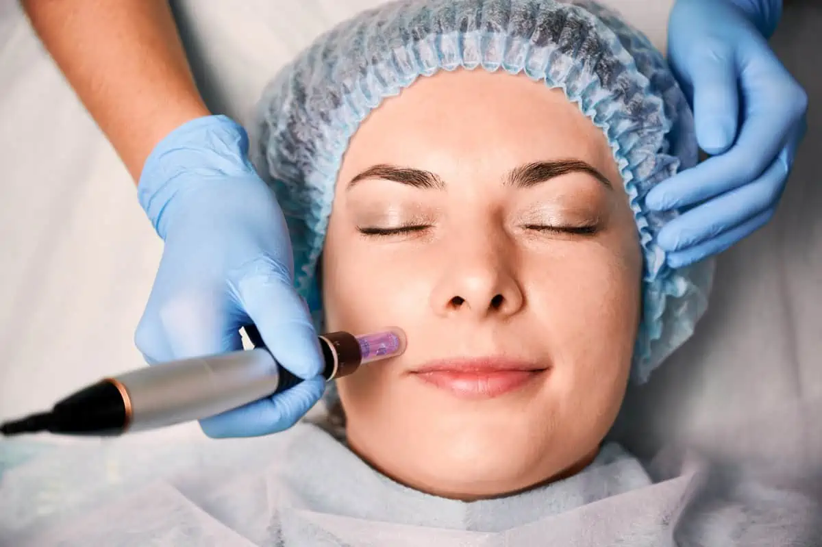 Microneedling by The Rejuvenation Center II, LLC in . Bethlehem Blvd. Wheeling WV